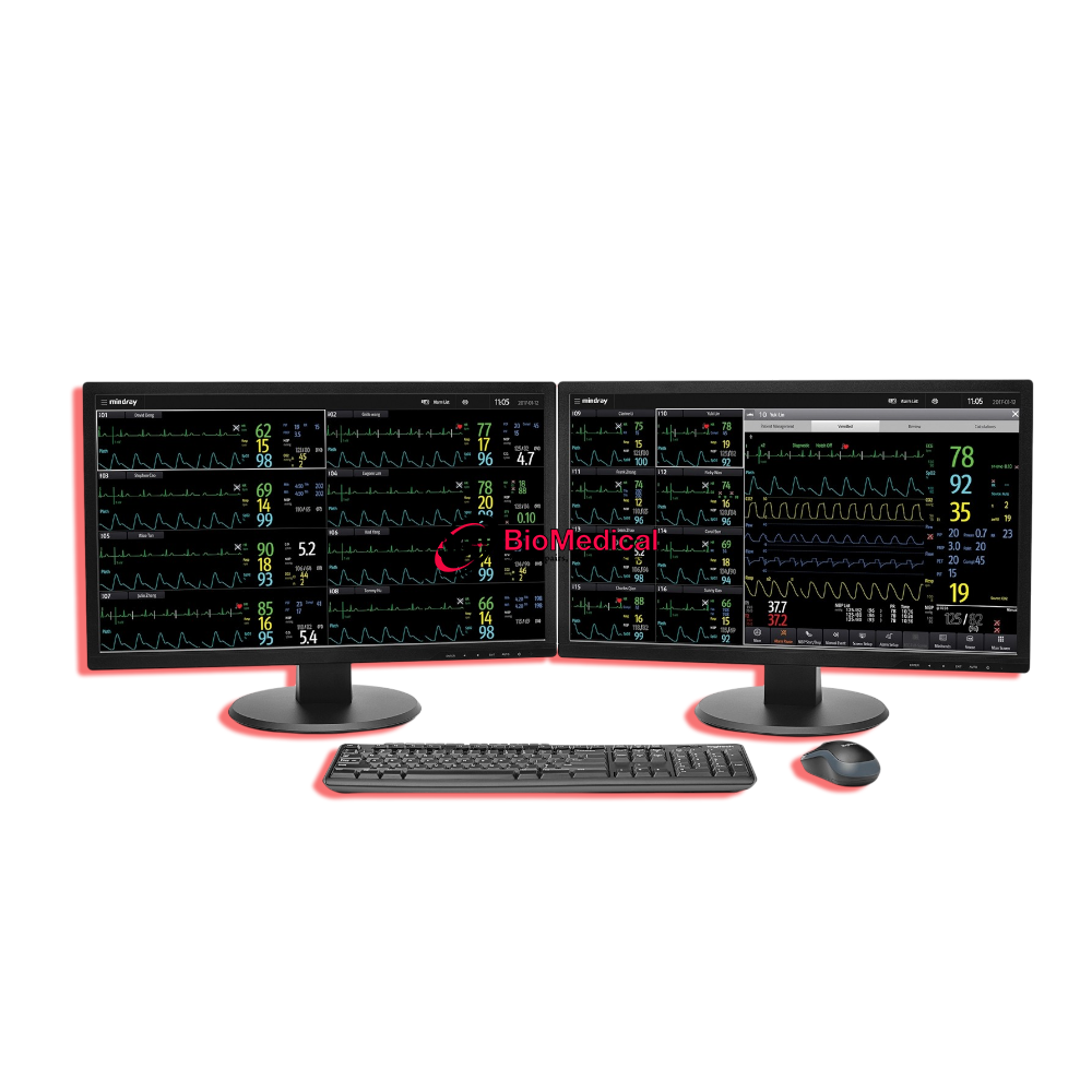 Mindray BeneVision Central Monitoring System